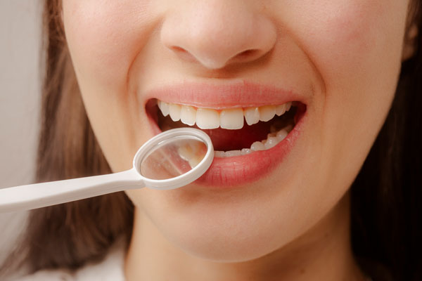 Lumineers Vs  Traditional Veneers: What To Know Before You Choose