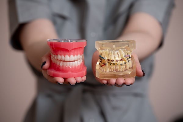 Is Invisalign The Right Teeth Straightening Procedure For Your Teeth?