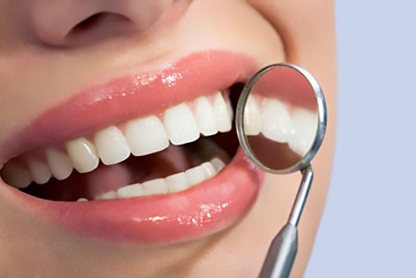 Can Veneers Cover Stained Teeth?