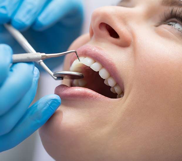 Colleyville Dental Bonding