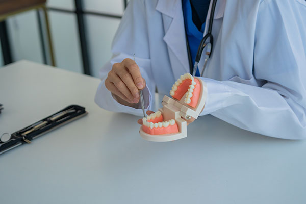 Dental Crown Solutions: Strengthening And Protecting Damaged Teeth
