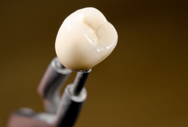 The Different Types Of Dental Crowns