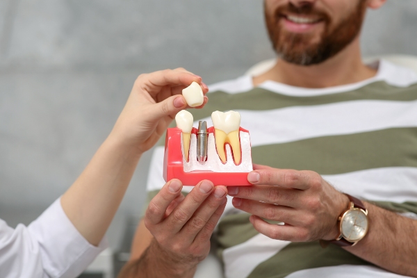 A General Dentist Explains The Process Of Getting Dental Implants