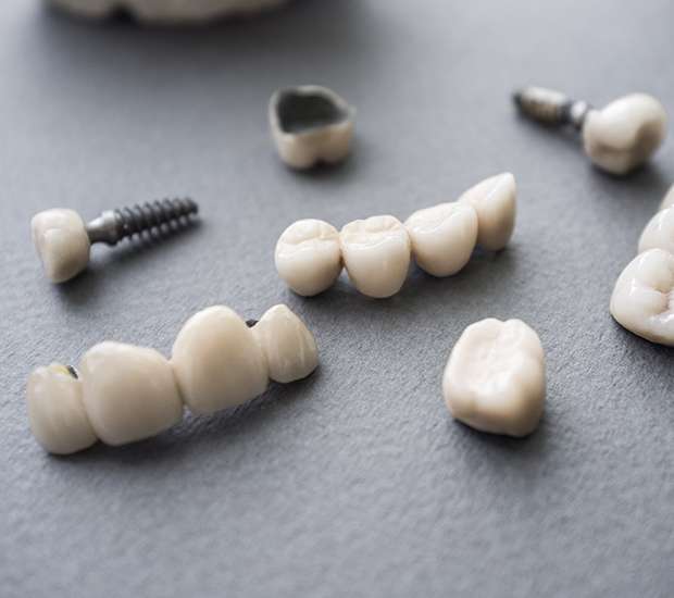 Colleyville The Difference Between Dental Implants and Mini Dental Implants