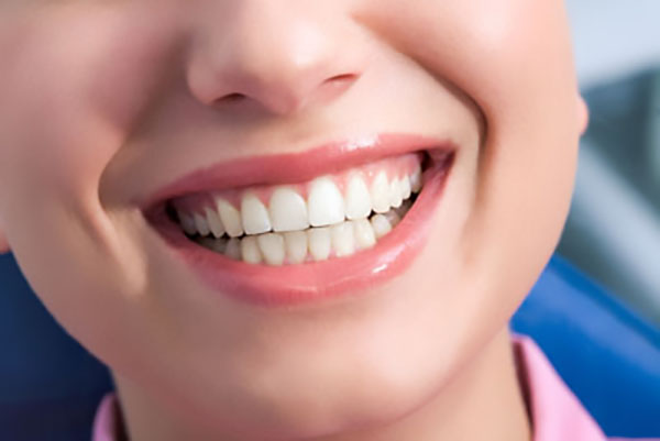 Popular Materials For CEREC® Dental Crowns