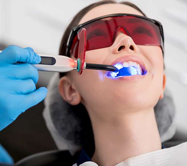Colleyville Professional Teeth Whitening