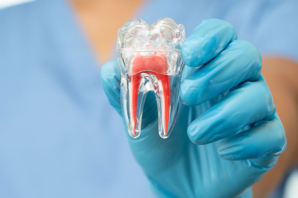 Root Canal Treatment: What To Expect And How It Saves Your Smile