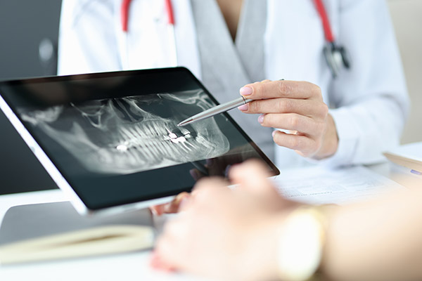 Receiving Root Canal Therapy From A Restorative Dentist
