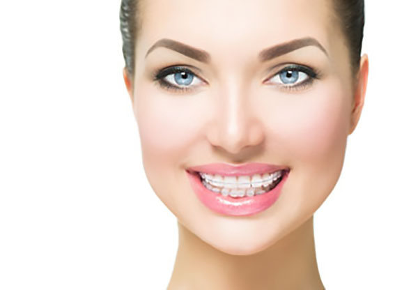 Why You Should Choose A Clear Braces Teeth Straightening Treatment
